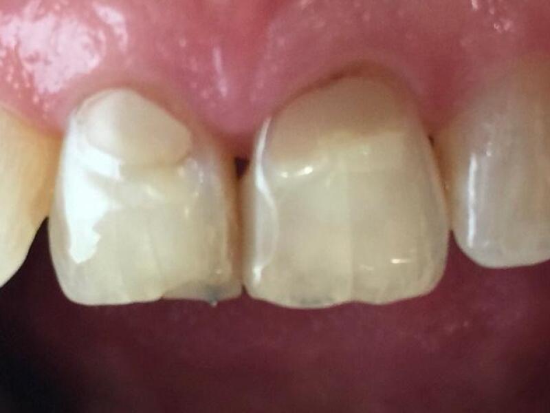 Before image