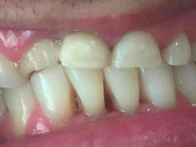 Before image