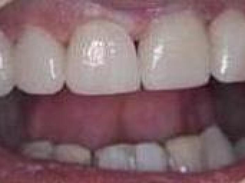After image