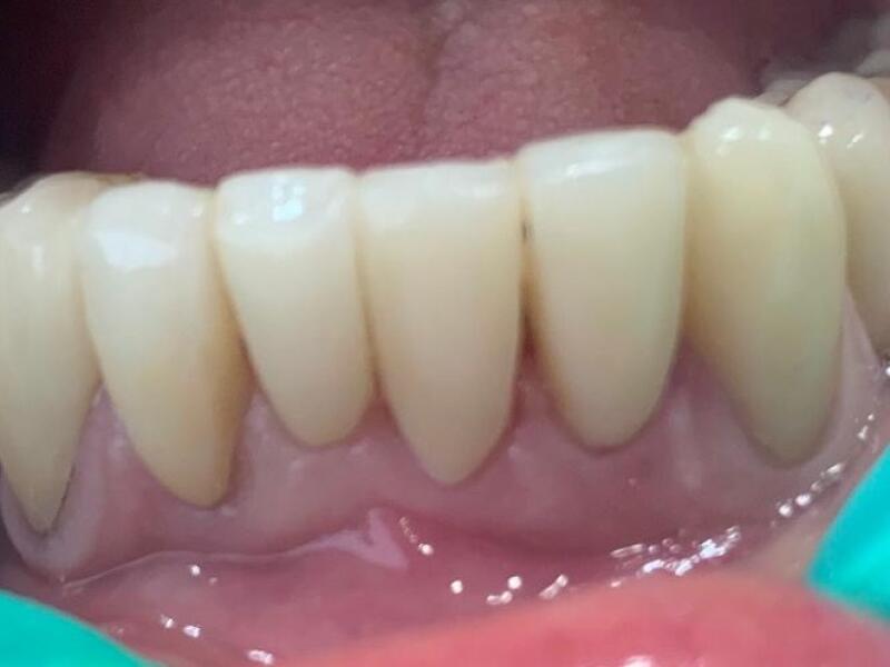 After image