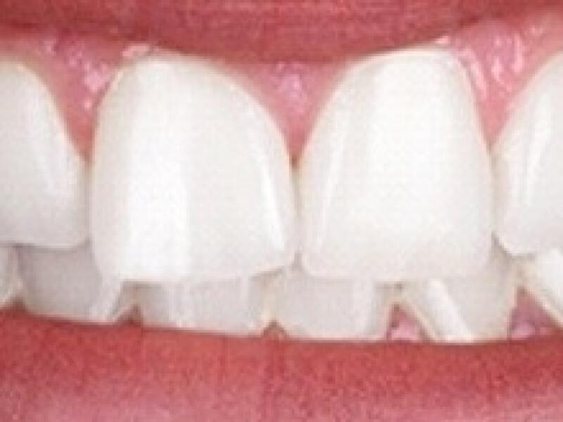 After image